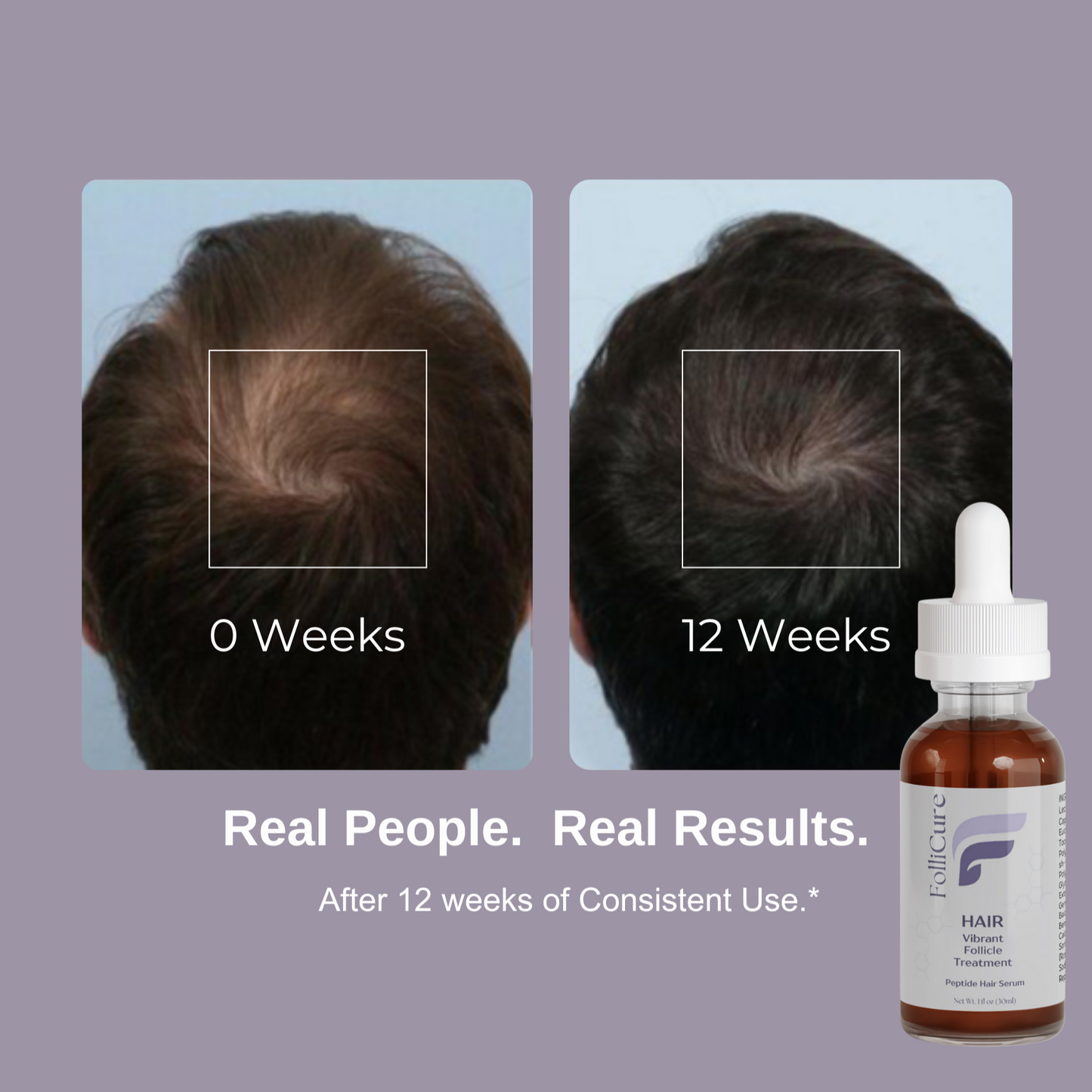 FolliCure Serum